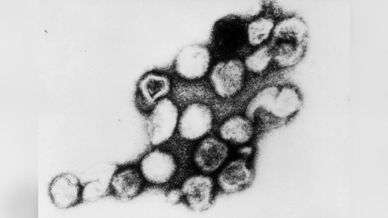 краснуха под микроскопом; фото: wikipedia.org/Centers for Disease Control and Prevention 