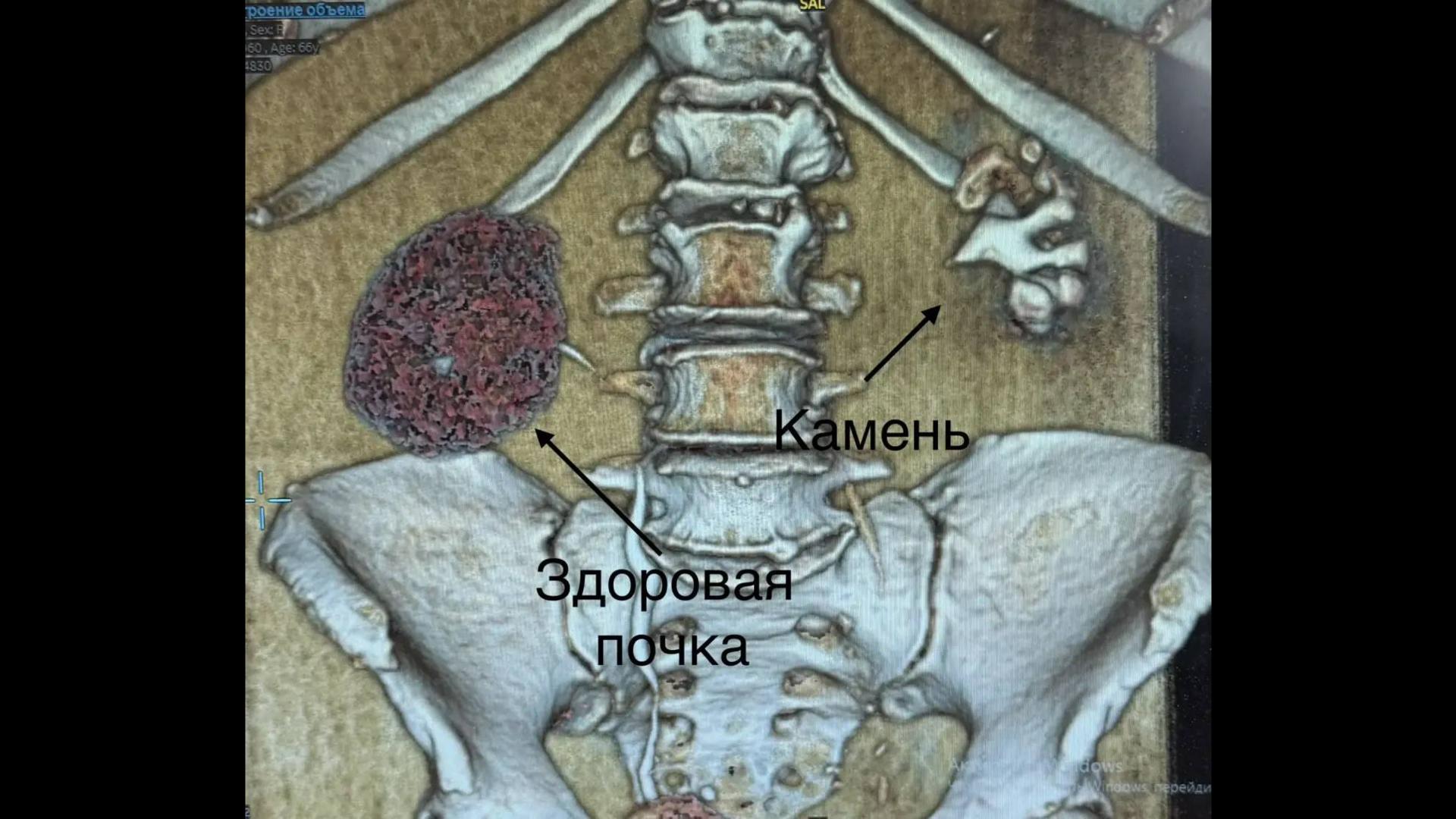 Пресс-служба НИИ им. Джанелидзе