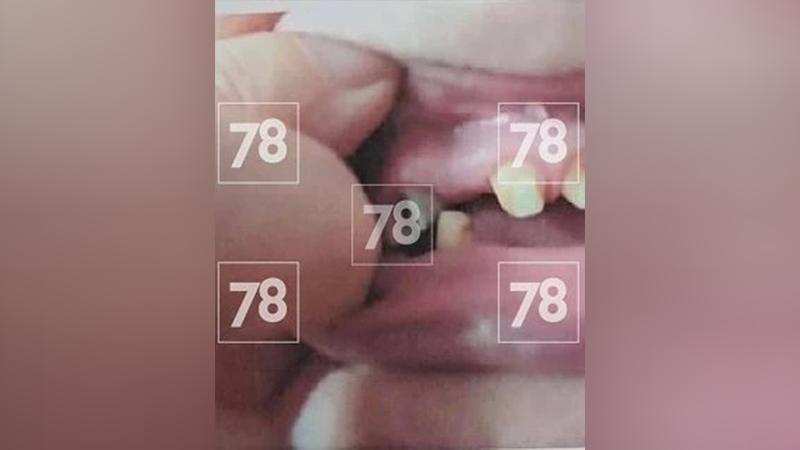 #