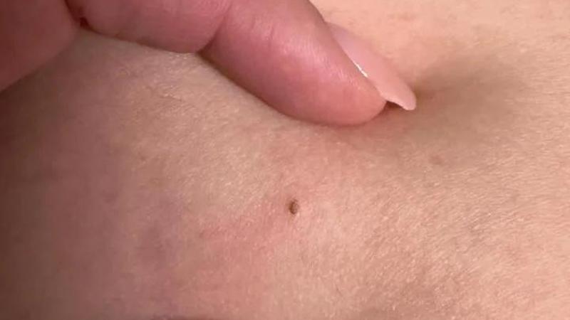 #